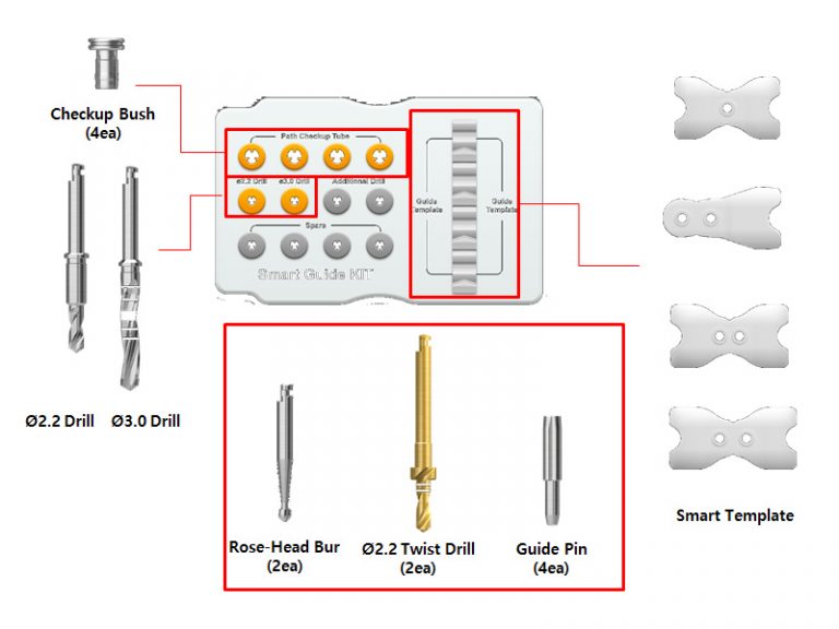 Smart Guide Kit Smart Guide Kit - Bursa İmplant İstek Dental